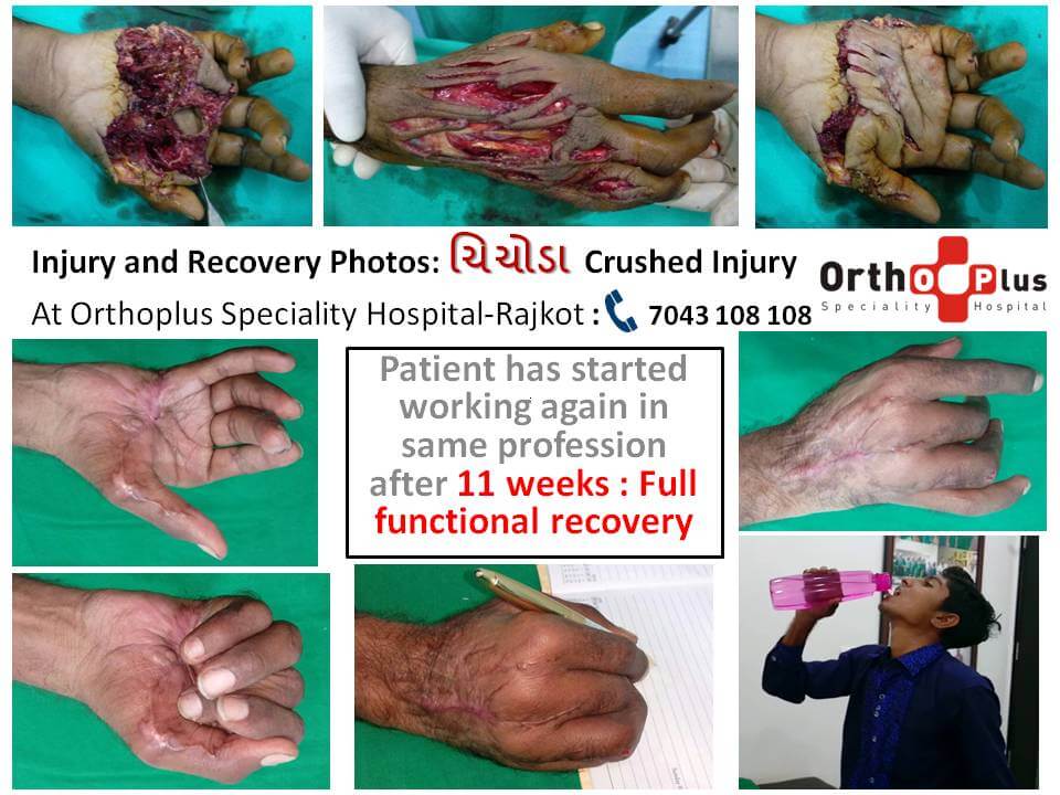 Chichoda Machine injury