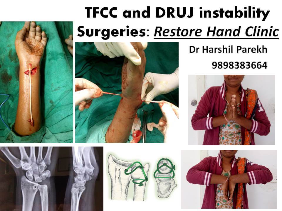 TFCC and DRUJ instability Surgeries