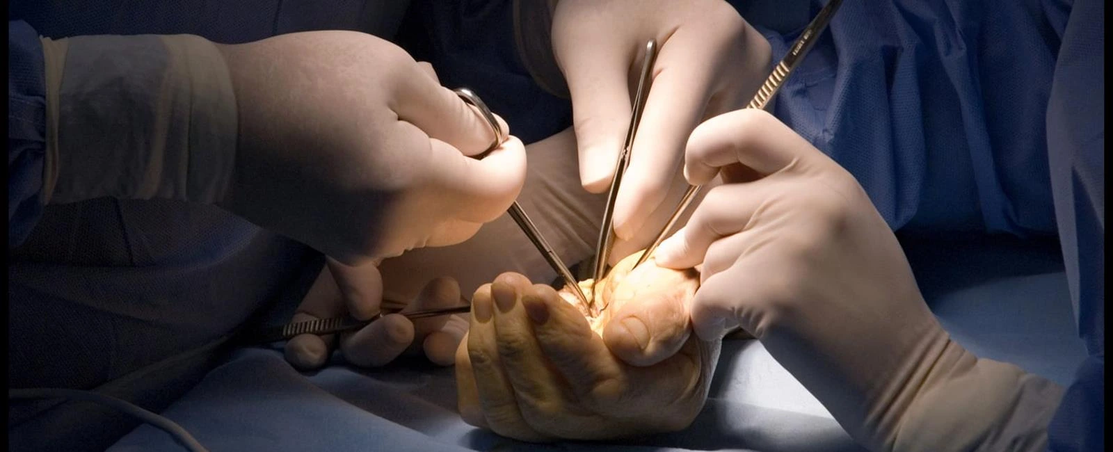 Hand & Microvascular Reconstruction Surgery