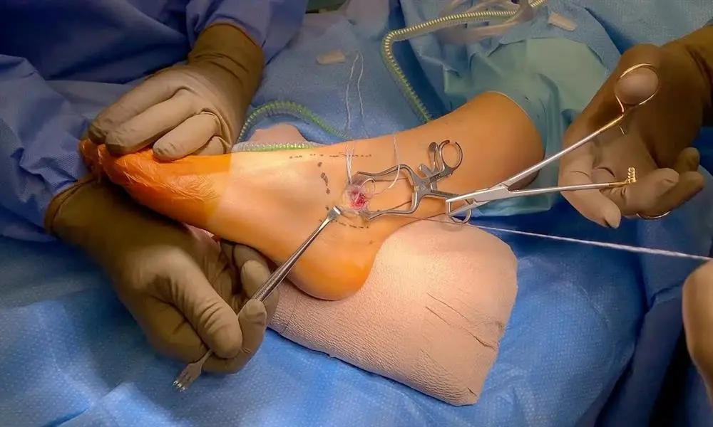 Foot and Ankle Surgery